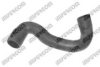 BMW 11531722216 Radiator Hose